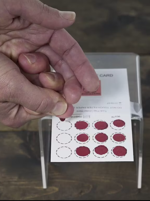 A person putting a blood sample on a ZRT collection.
